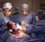 Η καισαρική τομή δεν σχετίζεται με επώδυνη σεξουαλική επαφή