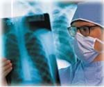 Ο προληπτικός ακτινογραφικός έλεγχος αυξάνει το ενδεχόμενο εκδήλωσης καρκίνου