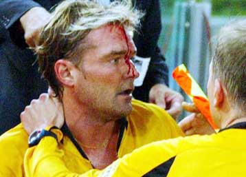 Μέχρι την Τρίτη θα περιμένει η Ρόμα την… καμπάνα της UEFA