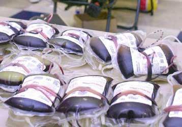 Χιλιάδες Βρετανοί ίσως εκτέθηκαν στη σπογγώδη εγκεφαλοπάθεια από προϊόντα αίματος