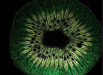 Πανίσχυρος τομογράφος παρακολουθεί το μεταβολισμό του εγκεφάλου