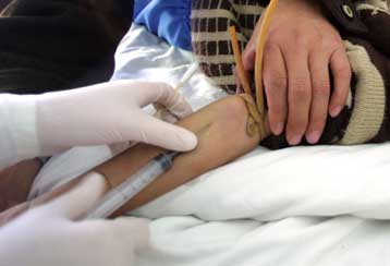 Κάμερα για φλέβες προφυλάσσει από τις αδέξιες νοσοκόμες