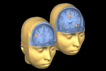 Τομογραφίες δείχνουν πώς η εκμάθηση ξένων γλωσσών αλλάζει τον εγκέφαλο