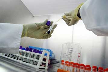 Έρευνα του ΠΟΥ για πιθανή μετάδοσης σύφιλης μέσω μεταγγίσεων αίματος στην Κροατία