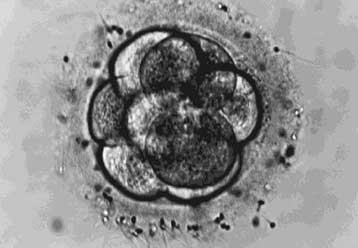 Αδεια για προεμφυτευτικό έλεγχο κατά του καρκίνου δόθηκε στη Βρετανία