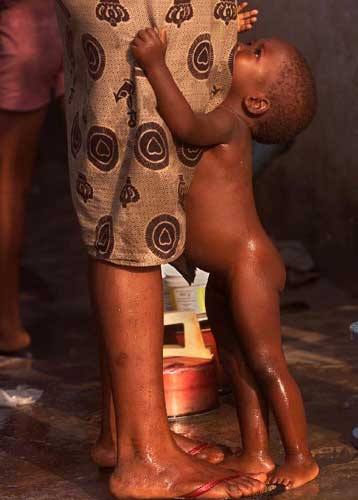 Δωρό ζωής για το ένα δέκατο του παγκόσμιου πληθυσμού το εμβόλιο κατά της ελονοσίας