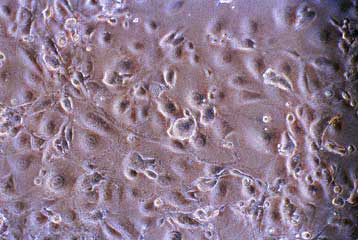 Yπέρ της έρευνας σε εμβρυϊκά κύτταρα ψήφισαν οι Ελβετοί