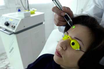 Λέιζερ νέου τύπου καταπολεμά τις ουλές της ακμής