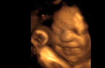 Οι υπέρηχοι δεν είναι επιβλαβείς για τα έμβρυα