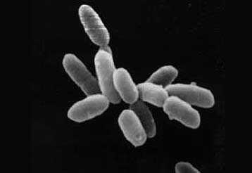 Σχεδόν ζωντανά συνθετικά κύτταρα δημιουργήθηκαν στις ΗΠΑ