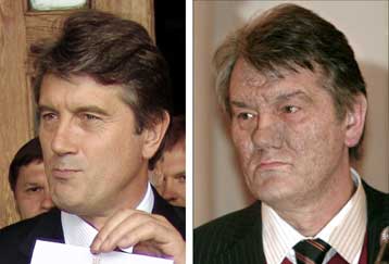 Θύμα δηλητηρίασης από διοξίνη ο Γιουστσένκο, επιβεβαίωσαν οι Αυστριακοί γιατροί