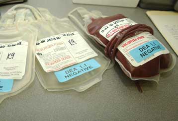 Ελπίδες μαζικής παραγωγής τεχνητού αίματος