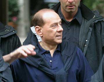 Καθησυχαστικός ο Μπερλουσκόνι μετά την επίθεση που δέχθηκε από 28χρονο Ιταλό