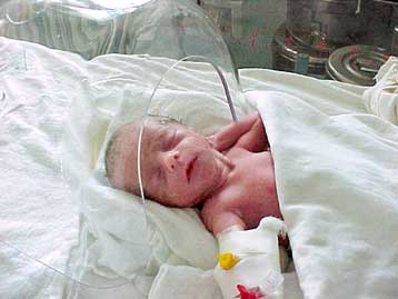 Ρουμάνα 66 ετών έγινε η πιο ηλικιωμένη μητέρα στον κόσμο