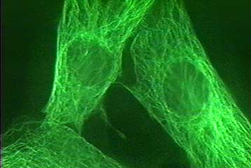 Μικρομηχανή αναπτύσσει μύες και αρχίζει να περπατά