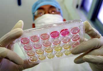 Ανθεκτικό και επικίνδυνο στέλεχος του HIV ανιχνεύθηκε σε Νεοϋορκέζο