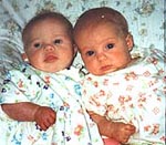 Όσο αυξάνεται ο ΔΜΣ της μητέρας αυξάνονται οι πιθανότητες γέννησης διδύμων