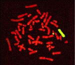 Αποκωδικοποιήθηκε το χρωμόσωμα Χ