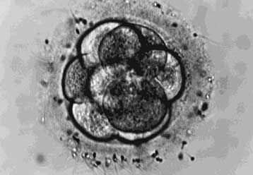 Γενικόλογη η διακήρυξη του ΟΗΕ κατά της κλωνοποίησης