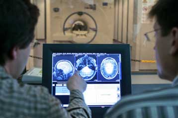 Τομογραφίες απεικονίζουν τη νόσο του Αλτσχάιμερ στον ζωντανό εγκέφαλο