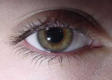 «Βιονικά μάτια» δίνουν στους τυφλούς ελπίδες για στοιχειώδη όραση