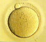 Επετεύχθη η δημιουργία ωαρίων από αρχέγονα κύτταρα