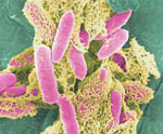 Προβιοτικά μικρόβια στη θεραπεία της διάρροιας των ταξιδιωτών