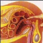 Παχυσαρκία και μέγεθος του προστάτη καθορίσουν την επιθετικότητα του καρκίνου