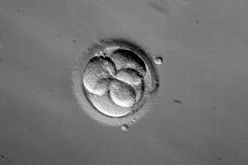 Μόριο της μήτρας στόχος για την υποβοηθούμενη αναπαραγωγή