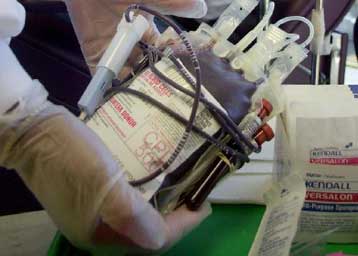 Διανομή μολυσμένων με HIV παρτίδων αίματος παραδέχεται ο Ερυθρός Σταυρός του Καναδά