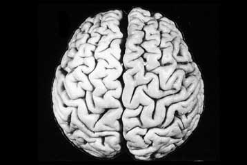 Φιλόδοξο πρόγραμμα επιχειρεί να δημιουργήσει ανθρώπινο «ηλεκτρονικό εγκέφαλο»