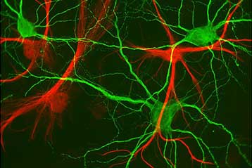 Νευρώνες δημιουργήθηκαν για πρώτη φορά στο εργαστήριο