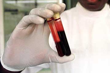 Τεχνητό αίμα παράγεται στο εργαστήριο από εμβρυϊκά κύτταρα