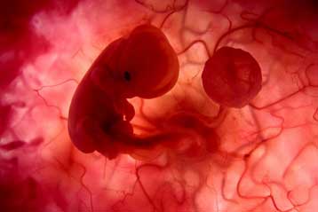 Βρέφος γεννήθηκε στις ΗΠΑ 13 χρόνια μετά τη σύλληψή του