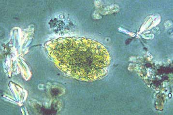 Τοξικό φυτοπλαγκτόν δηλητηριάζει κολυμβητές κοντά στη Γένοβα