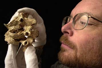 Νωρίτερα από το σύγχρονο άνθρωπο εμφανίστηκε η φυματίωση