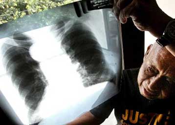 Στο Ευρωδικαστήριο οδεύει η Ελλάδα λόγω έλλειψης ειδικών χώρων ταφής αμιάντου