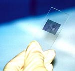 Γονιδιακό τεστ προβλέπει την επιθετικότητα της οξείας λεμβοβλαστικής λευχαιμίας