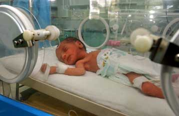 Έχασε τη μάχη με το θάνατο το βρέφος που γεννήθηκε με την καρδιά έξω από το σώμα του