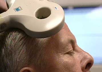 Θεραπεία με μαγνητικά πεδία καταπολεμά την κατάθλιψη