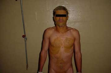 Παγκόσμια κατακραυγή από τις νέες φωτογραφίες – σοκ στο Αμπού Γκράιμπ