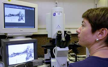 «Ας μην ξεχνάμε, ο καρκίνος του μαστού σκοτώνει και άνδρες»