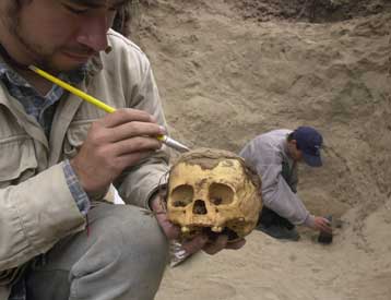 Η εγχείριση στο κρανίο πέτυχε, η ασθενής επέζησε… 28 αιώνες πριν