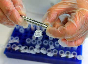 Ιός ίσως συνδέεται με τον καρκίνο του προστάτη