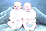 Ορμόνη καθιστά πιθανότερη την κυοφορία διδύμων