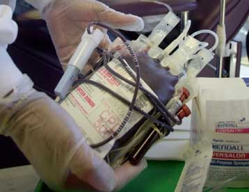 Ελλείψεις σε προσωπικό και προβλήματα υποδομών για το σύστημα αιμοδοσίας της χώρας