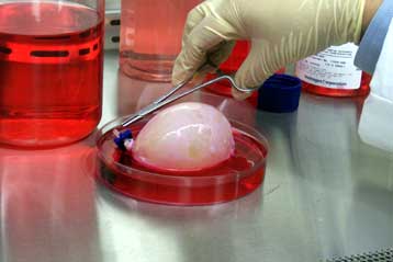 «Ορόσημο» η καλλιέργεια ουροδόχων κύστεων στο εργαστήριο