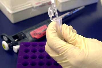 Γάλλοι και Ιάπωνες συγκρίνουν τα γονίδια τους για να κατανοήσουν τις ασθένειες