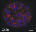 Γονίδιο της κώφωσης συμβάλλει στην ταχύτερη επούλωση των τραυμάτων