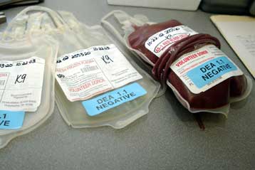 Νέα υπόθεση πιθανώς μολυσμένου με AIDS αίματος διερευνά το υπουργείο Υγείας